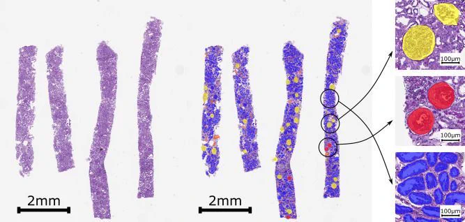 Figure 1 ComPRePS multi-compartment segmentation on a whole slide image (WSI).