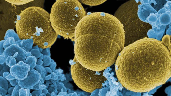 Bacteria 'S. aureus' escapando de la destrucción por leucocitos humanos./ Wikimedia.