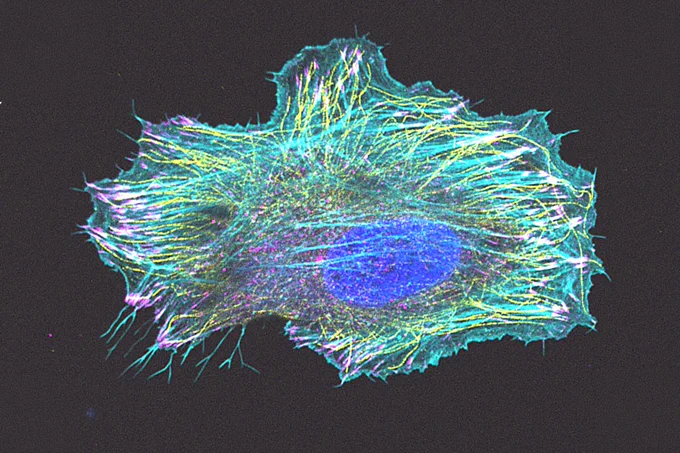 A cell labelled with dyes showing different cytoskeletal proteins