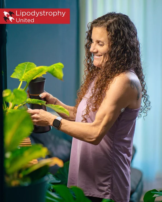  Lipodystrophy United graphic featuring Becky, a woman with long curly hair, smiling while holding a potted plant indoors. She is wearing a light purple sleeveless top and a glucose monitor on her upper arm. The Lipodystrophy United logo appears in the top left corner.
