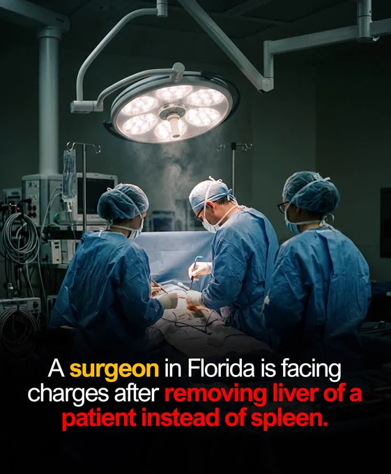 A surgeon in Florida is facing serious criminal charges after a surgery mistake caused a man to pass away. During an operation in 2024, the surgeon was supposed to remove the patient’s spleen, but accidentally removed his liver instead. The man passed away on the operating table after losing a large amount of blood.

In a legal statement later released publicly, the surgeon said the operation became chaotic because of heavy bleeding and pressure inside the operating room. He said he became emotionally overwhelmed and could not tell the difference between the organs during the emergency. He also admitted that the removed liver was incorrectly labeled as a spleen afterward.

The man’s wife later filed a lawsuit accusing the surgeon of malpractice and trying to hide the mistake. Investigators confirmed that the patient’s spleen was still inside his body while his liver had been removed instead.