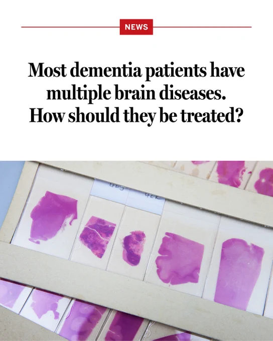 Most dementia patients have multiple brain diseases. How should they be treated?