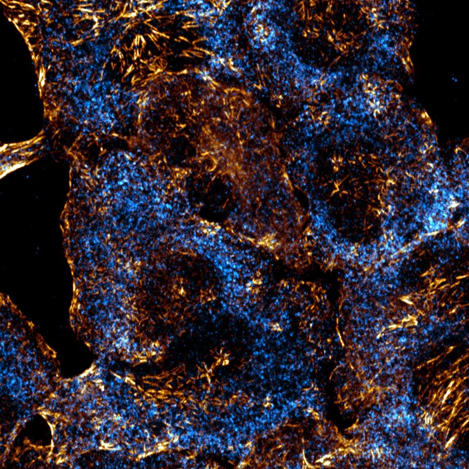 A microscopic image showing a network of cells stained with blue and orange fluorescent dyes. The blue areas highlight the nuclei, while the orange areas illuminate the cell structures, creating a complex pattern against a black background.