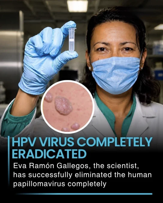 THE HPV VIRUS MAY HAVE JUST MET ITS MATCH…
For years, HPV has infected millions worldwide and often stays hidden without symptoms. Now, Mexican scientist Eva Ramón Gallegos has gained global attention after research showed her treatment successfully eliminated the virus in several patients.
The therapy uses a special light-based technique that targets infected cells while protecting healthy tissue. Scientists say more research is still needed, but the results are already giving hope for a future where HPV may no longer be permanent.
Source 
Ramón-Gallegos, E., et al. Photodynamic therapy as a treatment for human papillomavirus infection. Photodiagnosis and Photodynamic Therapy.
