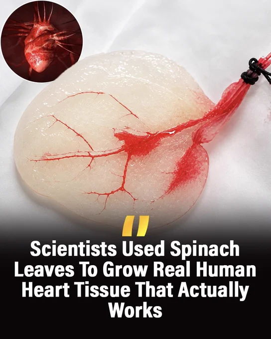 THIS SPINACH LEAF STARTED BEATING LIKE A HUMAN HEART
Scientists at Worcester Polytechnic Institute turned ordinary spinach leaves into living human heart tissue in a lab. After removing the plant cells, they used the leaf’s tiny vein network as a scaffold for human heart cells — and the cells began to grow and beat like real heart tissue.
Researchers believe this incredible discovery could one day help repair damaged hearts and even assist in growing human organs in the future. For now, the technology is still experimental, but the results are stunning.
Source 
Gershlak, J. R., et al. Crossing kingdoms: Using decellularized plants as perfusable tissue engineering scaffolds. Biomaterials.