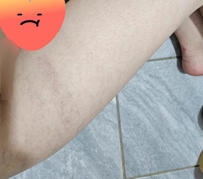 這也是大腿
是方方的拍子形狀🤣