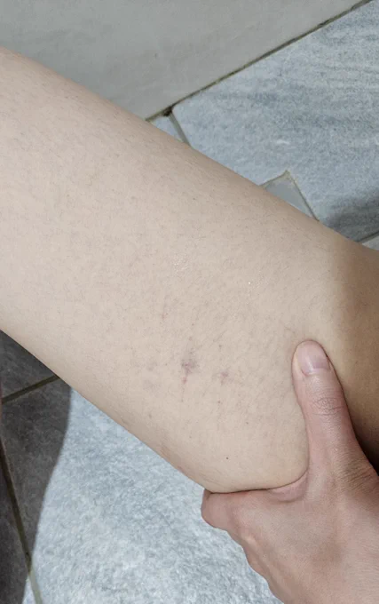 這是大腿
第一次在自己身上看到長長的鞭痕