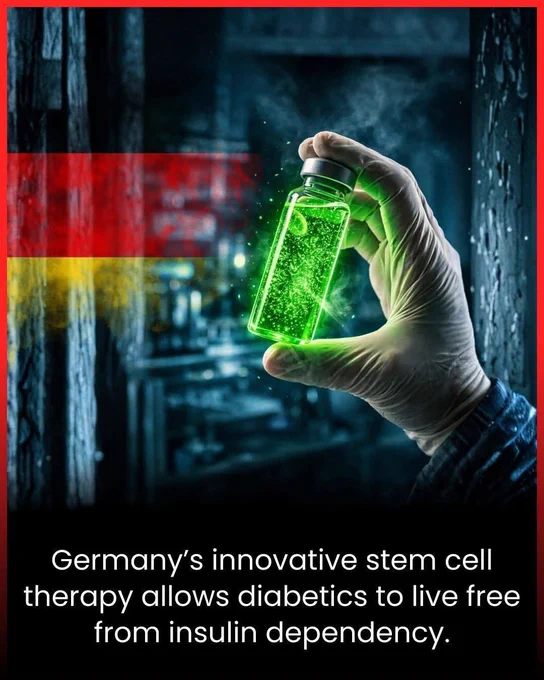 Germany’s stem cell therapy may let diabetics live without insulin

A revolutionary medical breakthrough is giving hope to millions of people living with diabetes. Researchers in Germany have developed a stem cell therapy that allows the body to produce its own insulin naturally. For decades, diabetics have relied on daily insulin injections or pumps to regulate blood sugar, but this new therapy could eliminate that dependency entirely.

The treatment works by transforming stem cells into functional insulin-producing cells, which are then implanted into the patient’s body. These cells respond to blood sugar levels in real time, just like a healthy pancreas. Unlike traditional methods that manage symptoms, this therapy addresses the root cause of diabetes and restores the body’s ability to regulate itself. Early trials show patients maintaining normal blood sugar without insulin injections for months, a feat once thought impossible.

This advancement is more than a medical achievement.