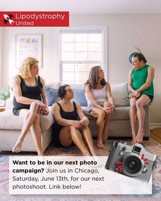 Four people sit together in a bright living room, appearing to have a conversation. The Lipodystrophy United logo appears in the top left corner. Text on the image reads: “Want to be in our next photo campaign? Join us in Chicago, Saturday, June 13th, for our next photoshoot. Link below!” A small illustrated camera graphic appears near the bottom right.