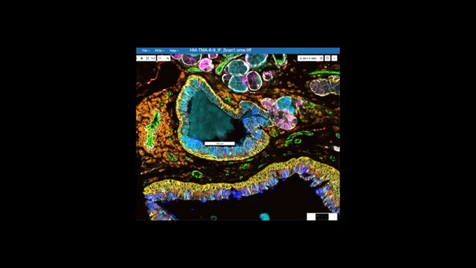 Multimodal image of airway epithelium, submucosal gland, and duct from the lung.

Lung - Airway Epithelium and Submucosal Gland and Duct
PTPRC - CD45 - Orange - immune cells
PECAM1 - CD31 - Green - endothelial cells
KRT5 - Yellow - basal epithelial cells
ACTA2 - White - smooth muscle cells
FOXJ1 - orange in epithelium, motile ciliated cells
SCGB3A2 - pink - lung epithelial cells and submucosal glands
SFTPB - pulmonary surfactant protein
MUC5AC - bright blue - gel-forming glycoprotein in the lungs
MUC5B - turquoise - gel-forming mucin protein