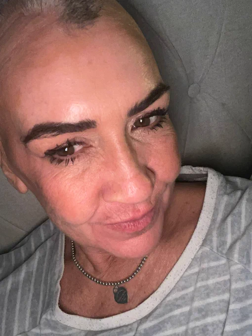 Tracey is a white woman in her 40s with alopecia. She has dark eyebrows and thick eyelashes and takes a selfie on her sofa at home.