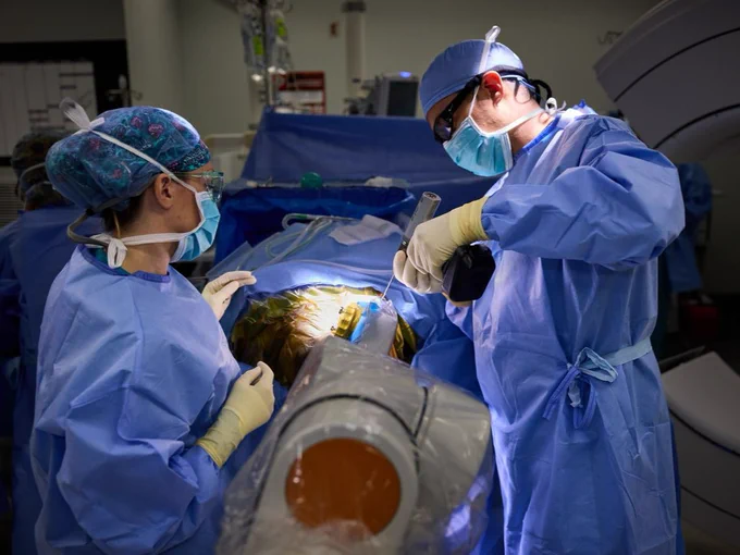 Medical professionals in blue surgical attire perform a LITT (Laser Interstitial Thermal Therapy) procedure in an operating room. They focus on the patient under bright surgical lights. Nearby equipment and monitors assist in the operation.