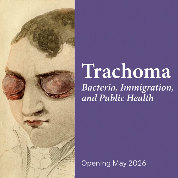 Promotional graphic split into two sections. On the left, an illustrated close-up of a child’s face shows severely swollen, inflamed eyes. On the right, a purple background features large white text reading “Trachoma: Bacteria, Immigration, and Public Health,” with smaller text below stating “Opening May 2026.”