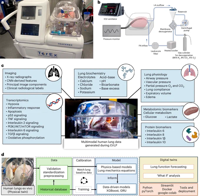 Figure 1 from linked paper by Zhou et al. (2026), titled: “EVLP generates organ-specific multimodal data for digital lung model construction,” with the caption: “a, A representative image of human lungs on the EVLP system (photograph source: UHN). b, Schematic drawing of the individual circuit components for the EVLP system. c, Examples of the multimodal and organ-specific data (light-blue boxes) generated during EVLP, which can be analyzed using ML to create DTs of human lungs (center) (photograph source: UHN). d, Summary of workflows and implementation approach for ex vivo human lung DTs (image source: UHN). Panel b adapted from ref. 7 and created in BioRender; Zhou, E. https://biorender.com/02j2eeo (2026).” 