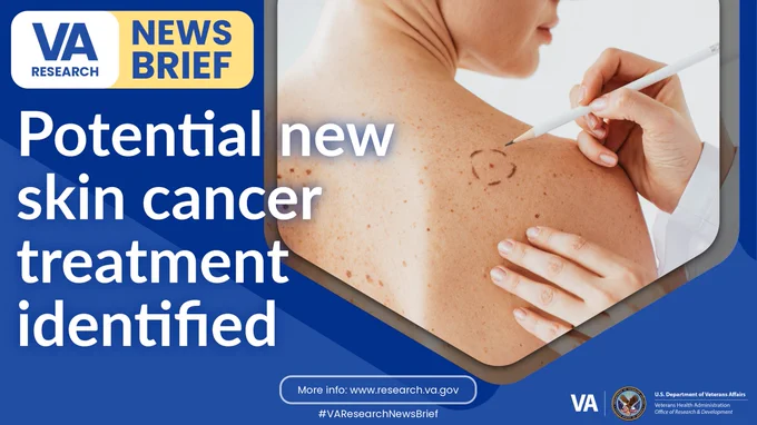 Potential new skin cancer treatment identified 