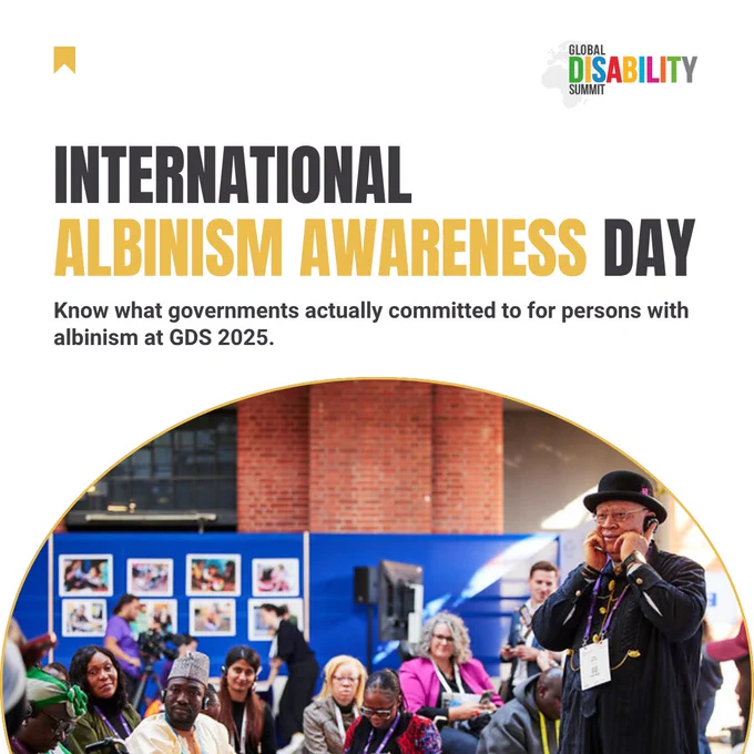 Promotional graphic for International Albinism Awareness Day by the Global Disability Summit. Large bold text reads “International Albinism Awareness Day” with the message: “Know what governments actually committed to for persons with albinism at GDS 2025.” The Global Disability Summit logo appears in the top-right corner on a light grey background.