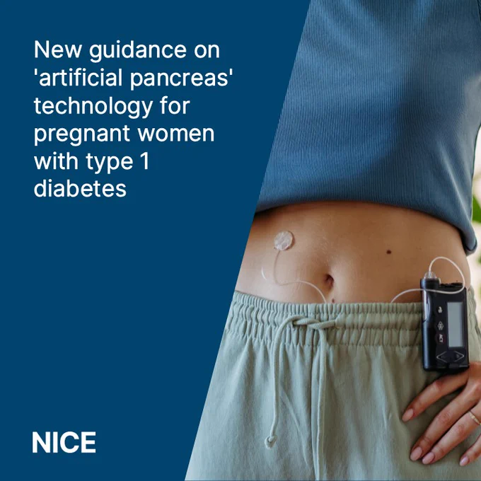 A picture shows a woman wears a hybrid closed loop device. The text reads: "New guidance on 'artificial pancreas' technology for pregnant women with type 1 diabetes."