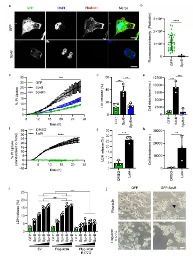 Actin ribosylation is an essential prerequisite for SpvB-dependent cell death. HeLa cells were transfected with pEGFP-N1 or ptCMV-GFP-SpvB and analyzed by confocal microscopy 24 h post-transfection.