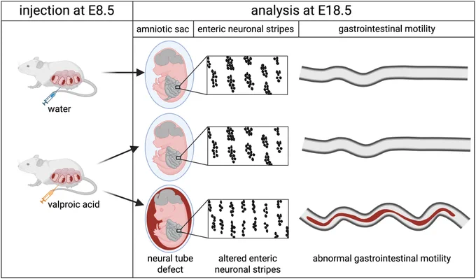 Key Points

VPA exposure is a reliable model of neural tube defects with variable intralitter susceptibility.
Fetuses with a VPA-induced neural tube defect have blood in the amniotic sac and within the lumen of the gastrointestinal tract.
Enteric nervous system organization is abnormal in the duodenum and jejunum of fetuses with a VPA-induced neural tube defect, with thinner enteric neuronal stripes and narrower interstripe distance.
Ex vivo gastrointestinal motility is abnormal in the duodenum and jejunum of fetuses with a VPA-induced neural tube defect, including increased contraction frequency and increased length of the contractile segment.
