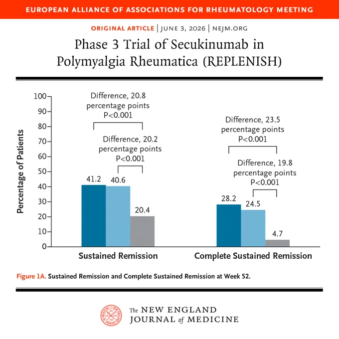 Chart from an article published in the New England Journal of Medicine showing results from a phase 3 trial of secukinumab in polymyalgia rheumatica. Two bar graphs depict sustained remission and complete sustained remission at week 52, comparing secukinumab, 300 mg (dark blue bars); secukinumab, 150 mg (light blue bars); and placebo (grey bars). Statistical significance is noted with P<0.001 for each comparison.