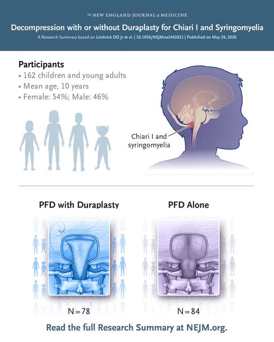 This image is from a Research Summary published in the New England Journal of Medicine about decompression with or without duraplasty for Chiari I and syringomyelia. It includes a diagram of the brain highlighting Chiari I and syringomyelia, information about study participants, and images comparing two groups: PFD with duraplasty and PFD alone. Participants included 162 children with an average age of 10 years; 54% are noted as female, and 46% as male. The images indicate the sample sizes for each group: 78 for PFD with duraplasty and 84 for PFD alone. A prompt invites readers to view the full Research Summary at NEJM.org. 