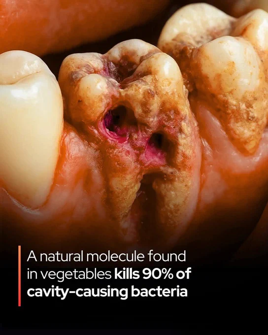 🥦 Compound Found in Broccoli Kills 90% of Cavity-Causing Bacteria

A natural molecule from vegetables could transform dental care.

Scientists have discovered that a molecule produced when we eat cruciferous vegetables — like broccoli, kale, cabbage, and Brussels sprouts — can wipe out the bacteria that cause cavities. The compound, known as 3,3′-Diindolylmethane (DIM), killed 90% of Streptococcus mutans biofilms in lab tests, according to a new study by Ben-Gurion University, in collaboration with researchers from Singapore and China.

Streptococcus mutans is the main culprit behind plaque and tooth decay. It forms sticky biofilms on tooth enamel, which trap acids that erode the surface and cause cavities. DIM appears to disrupt the bacteria’s ability to form those films, effectively dismantling their protective layer and leaving them vulnerable.

The findings are still preliminary — the experiments were conducted in vitro, not yet in humans.