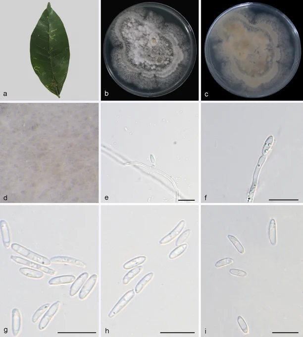 9 images of Microdochium acronychicola (SAUCC620701, ex-type). a. A diseased leaf of Acronychia pedunculata; b, c. Colony on PDA from above and below after 14 days; d. Colony overview; e, f. Conidiogenous cells with conidia; g–i. Conidia. Scale bars: 10 μm (e–i).