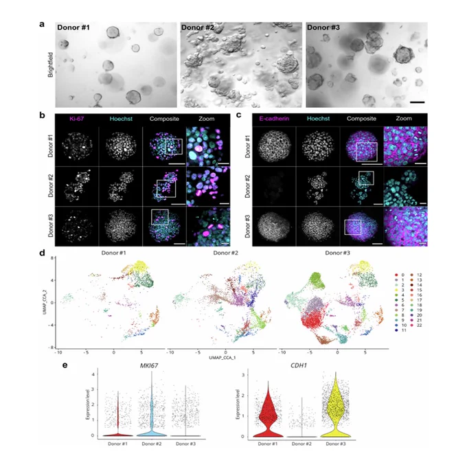 Necroptosis triggers inflammatory interferon signatures in patient-derived metastatic breast cancer organoids
