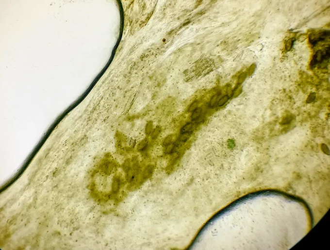 Roundworm eggs (capillaria erinacei) in Merlin's poo sample.