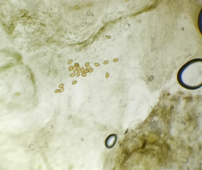 Fluke eggs in Merlin's poo sample.