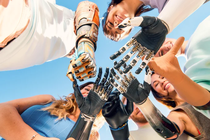 A group of people stand in a circle outdoors, reaching hands together in a team gesture. Several of the hands are advanced prosthetic arms with detailed mechanical fingers, highlighting a mix of human and assistive technology under a bright blue sky.