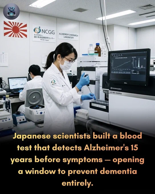 THEY CAN NOW SEE ALZHEIMER’S 15 YEARS BEFORE IT BEGINS
Imagine finding out a disease is silently growing inside the brain… more than a decade before the first memory slip ever appears.
That is exactly what Japanese scientists are working toward.
Researchers have developed a powerful blood test that may detect signs of Alzheimer’s disease up to 15 years before symptoms begin. Instead of waiting for memory loss, confusion, or personality changes, doctors could someday spot the warning signs early enough to slow or even prevent dementia before it takes control.
The shocking part?
This tiny blood sample can detect abnormal brain proteins linked to Alzheimer’s long before the brain suffers major damage. Scientists say this could completely change how the world fights one of the most feared diseases of aging.
For decades, Alzheimer’s was usually discovered too late. But now, the future may look very different.
A simple test.
A hidden disease.