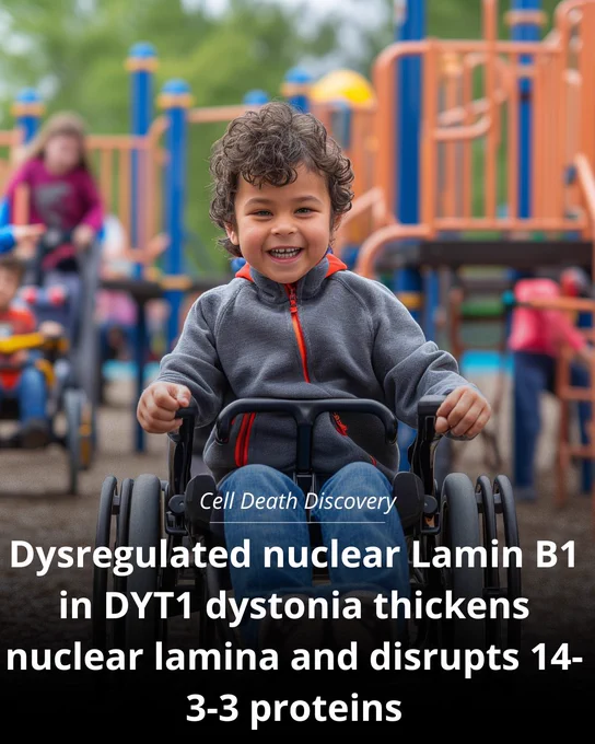 Young boy at playground in wheelchair smiling with text "Cell death discovery. Dysregulated nuclear Lamin B1 in DYT1 dystonia thickens nuclear lamina and disrupts 14-3-3 proteins