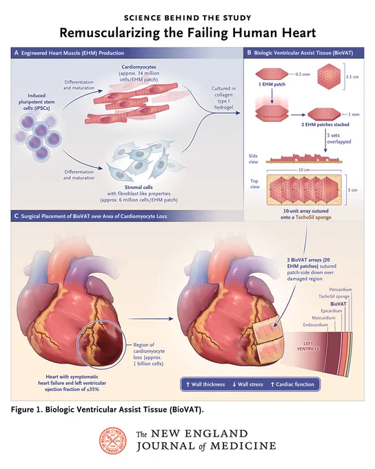 Diagram illustrating "Biologic Ventricular Assist Tissue (BioVAT)" from the editorial "Remuscularizing the Failing Human Heart" published in the New England Journal of Medicine. It includes three sections: A) Engineered Heart Muscle (EHM) production, B) Biologic Ventricular Assist Tissue (BioVAT), and C) Surgical Placement of BioVAT over Area of Cardiomyocyte Loss.