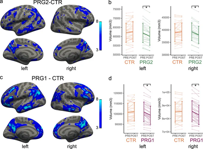 Fig. 1: Vertex-wise analysis of cortical volume change between multiparous, primiparous and control women.
DOI: 10.1038/s41467-026-69370-8