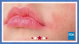 Close-up photo of a woman showing an allergic reaction on her cheek from a cosmetic product. FDA logo in the lower right corner. 
