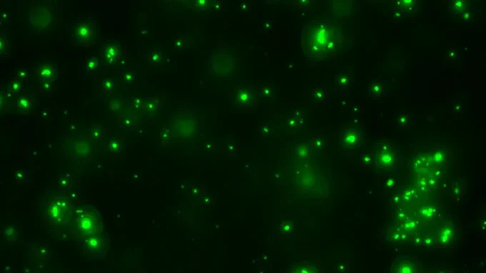 Green fluorescing dots of lipofuscin in the brain of a mouse lacking PPT1. Image from the Chandra lab.