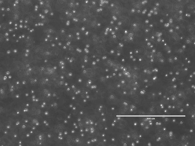 Dozens of small, white cells cover a dark grey background. There are clusters of cells that are touching, and some are spread apart. Some of the circles have brighter areas in the middle, and some appear dull as if they are further away.