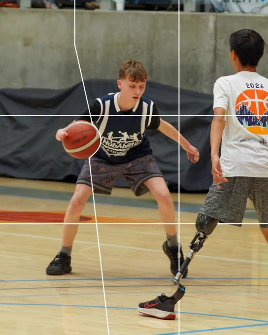 Two individuals are playing basketball indoors. One person dribbles a ball wearing a striped tank top and shorts. The other player, wearing a white shirt has a prosthetic leg. They appear focused on the game.
