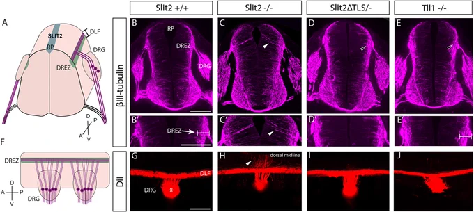 The Slit2ΔTLS allele retains dorsal midline repulsion of DRGs axons. (A,F) Dorsal root ganglia (DRG) axons enter the spinal cord at the dorsal root entry zone (DREZ) and bifurcate to project anterior and posterior in the dorsolateral funiculus (DLF), avoiding the SLIT2-expressing roof plate (RP). A, anterior; D, dorsal; P, posterior; V, ventral. (B-E) βIII-tubulin labeled transverse sections of E10.5 spinal cords. Dorsal midline projection errors were seen in Slit2−/− (arrowhead), but not in Slit2ΔTLS/− or Tll1−/− embryos (empty arrowheads). Dorsal is up in all images. (B′-E′) Magnifications of the DREZ region (arrowhead). Brackets indicate DRG axons in the spinal cord. (G-J) DiI tracer label was placed in DRGs (asterisk) of whole E11.5 embryos. (G) Wild-type embryos had no axons projecting towards the roof plate (n=4 embryos). (H) Slit2−/− embryos had overshooting DRG axons that invaded the ventricular zone toward the midline (arrowhead; n=2 embryos). (I) Slit2ΔTLS/− embryos lack over