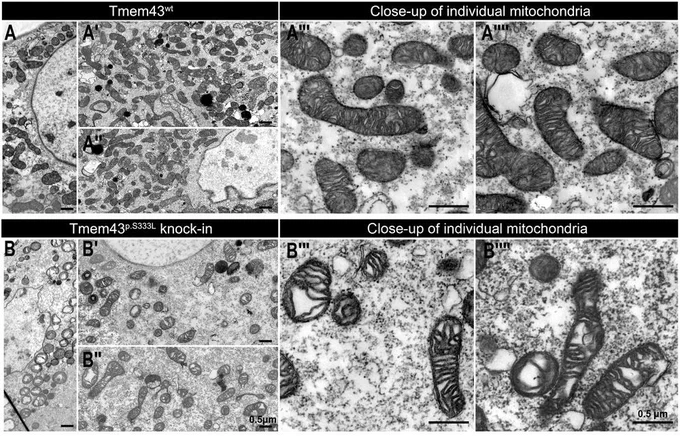 The Tmem43p.S333L knock-in line exhibits morphological defects in mitochondria. (A) Representative TEM images of body wall musculature from control Drosophila samples (Tmem43wt). (A′–A″″) Different orientations and close-ups of individual mitochondria are shown (insets). (B) Representative TEM images of body wall musculature from transgenic Tmem43p.S333L knock-in Drosophila samples. (B′–B″″) Different orientations and close-ups of individual mitochondria are shown (insets). 