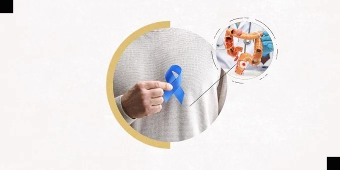 A photo of a person holding a blue ribbon in a circle frame. There is another photo in a smaller circle frame that is of a diagram of colon." The background is white.