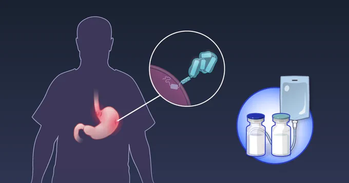 A silhouette of a person with a highlighted stomach. A magnified view shows human epidermal growth factor receptor 2. To the side, medical supplies including two vials and an IV bag are displayed, representing zanidatamab plus tislelizumab plus chemotherapy.
