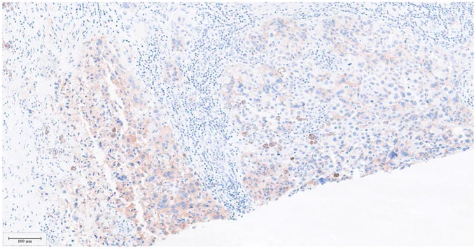 Synaptophysin.