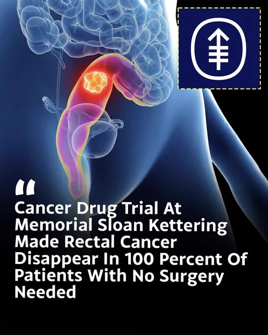 🚨 CANCER DISAPPEARED WITHOUT SURGERY 
A groundbreaking trial at Memorial Sloan Kettering Cancer Center stunned doctors when every patient with a specific type of rectal cancer showed no detectable signs of disease after treatment with the immunotherapy drug dostarlimab.
Even more remarkable, many patients avoided surgery, chemotherapy, and radiation. The drug works by helping the immune system recognize and attack hidden cancer cells.
While this treatment currently applies only to certain patients with a specific genetic mutation, the results are being called one of the most promising breakthroughs in cancer research.
Source
Memorial Sloan Kettering Cancer Center. (n.d.). Rectal cancer disappears after experimental use of immunotherapy, now an FDA designated breakthrough therapy.