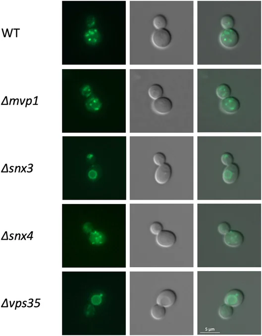 Intracellular distribution of the Vps10Δ/Vps68 CT chimera in different sorting nexin and retromer mutants. Plasmid pRK2075, expressing the Vps10Δ reporter with the Vps68 C-terminus, was transformed into different strains. From top to bottom: BY4741 (WT), Y01654 (Δsnx3), Y01386 (Δsnx4), RKY2074 (Δvps35), Y06533 (Δmvp1). From left to right: sfGFP staining, DIC picture, merged picture.