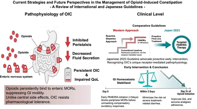 Highlights

Opioid-induced constipation impairs quality of life and decreases analgesic adherence.
Conventional laxatives often fail to address the μ-opioid receptor-mediated mechanism causing constipation.
Japanese guidelines advocate for early intervention with peripherally acting μ-opioid receptor antagonists.
Naldemedine shows long-term efficacy and safety for the relief of constipation without affecting analgesia.