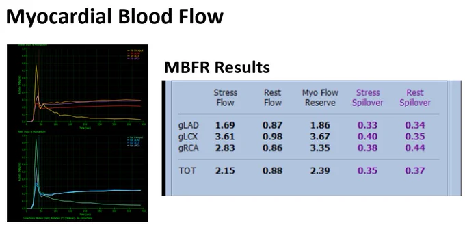 Myocardial blood flow 