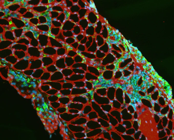 Disease Models & Mechanisms. Bongetti et al. Immunofluorescence of diaphragm muscle cross-section reveals infiltration of CD68  immune cells (green) between muscle fibres (laminin; red) with nuclei (blue, DAPI) 14 days after zymosan-induced critical illness in mice. Image acquired by Dr Amy Bongetti.