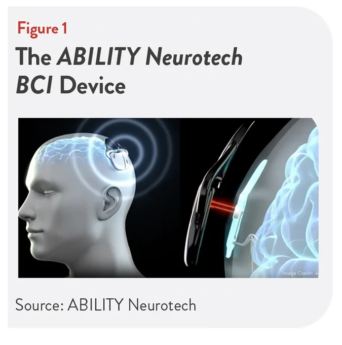 Brain-computer interfaces are getting closer to real-world patient care. ABILITY Neurotech is developing a BCI platform aimed at restoring speech and mobility for neurological patients: https://bit.ly/4vhurDL #medtech